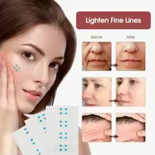 Cinta de lifting facial invisible - vista adicional
