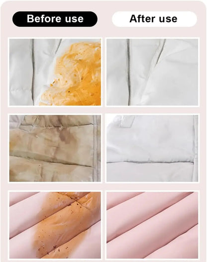 Instant Stain Remover Wipes — Individually Wrapped, No-Wash